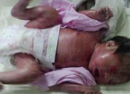 南通试管助孕医院有哪些？附南通试管助孕费用参考