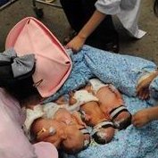 去广州单身做试管婴儿费用有哪些？一般几次成功